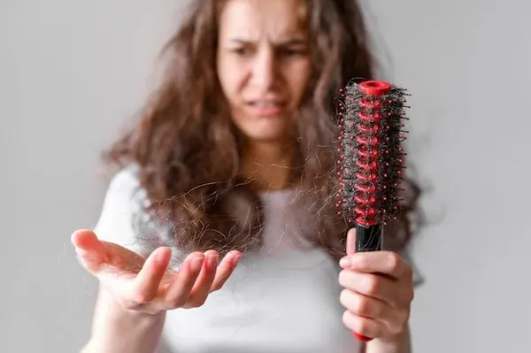 ¿El minoxidil acelera la caída inicial?